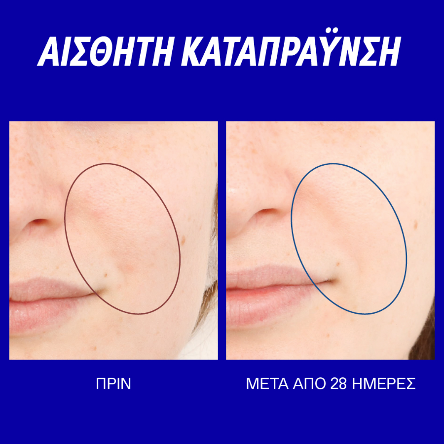 Korres Smart Yoghurt Probiotic Super Serum για Ενυδάτωση, Καταπράυνση και Εξισορρόπηση της Επιδερμίδας