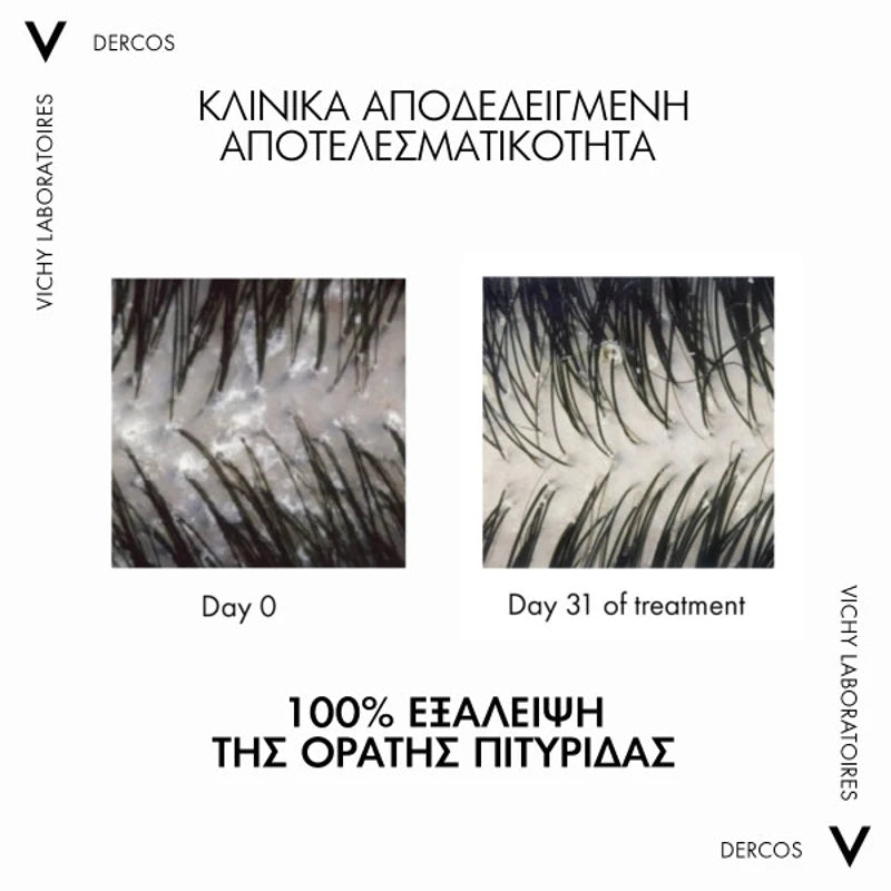 Vichy Dercos Anti-Dandruff DS 2in1 Shampoo & Conditioner κλινικά αποτελέσματα
