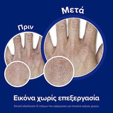 Neutrogena Hand Cream Concentrated Unscented 75ml πριν και μετά χρήση