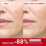 Vichy Liftactiv Pigment Specialist B3 SPF50 κρέμα προσώπου για πανάδες και δυσχρωμίες