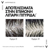 Vichy Dercos Αντιπυτιριδικό Σαμπουάν Για Κανονικά Έως Λιπαρά Μαλλιά 200mL - Παρουσίαση 8